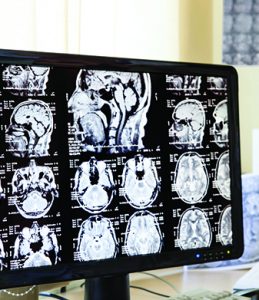 Doctor in hospital looking at ct scan